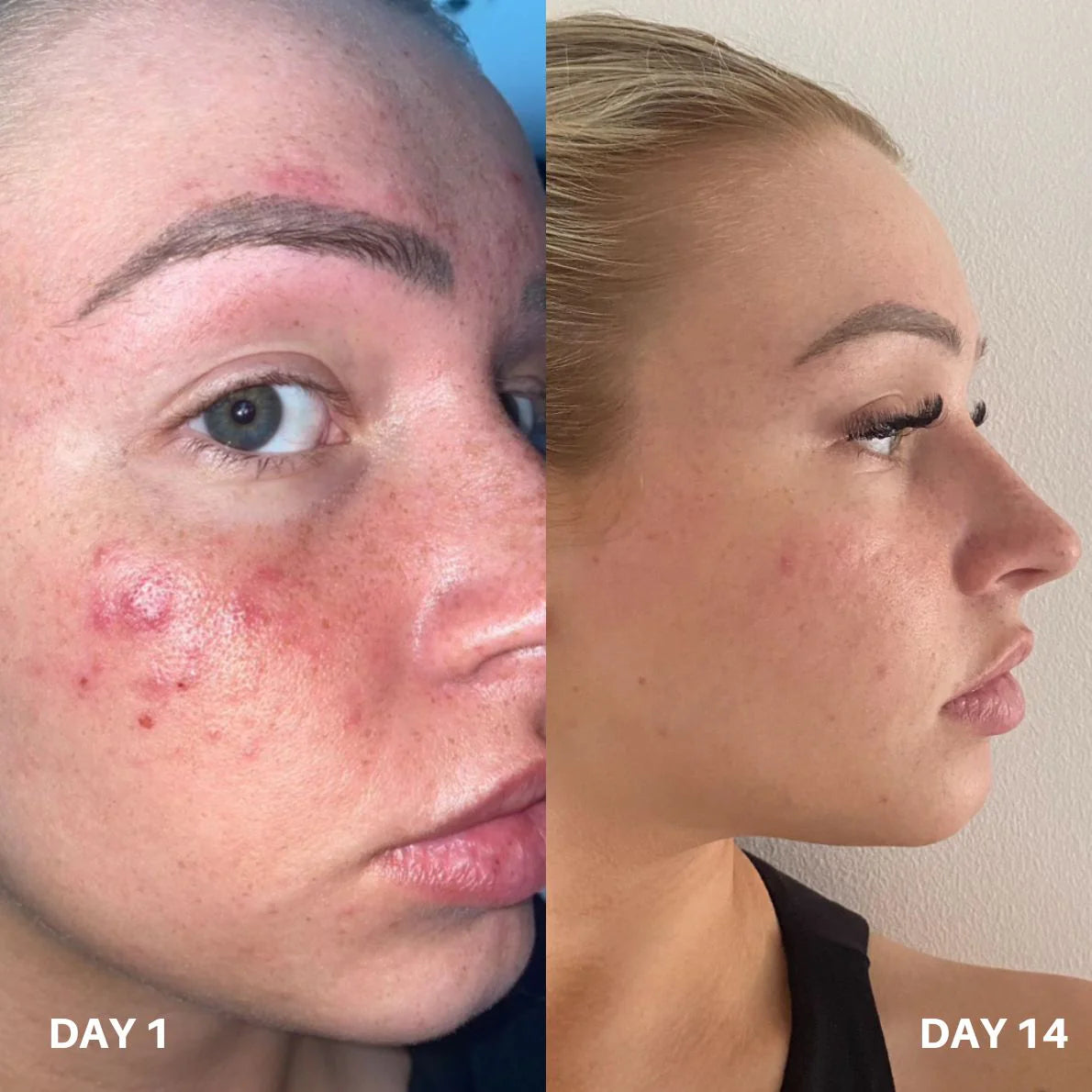 Clinisoothe+ Skin Purifier