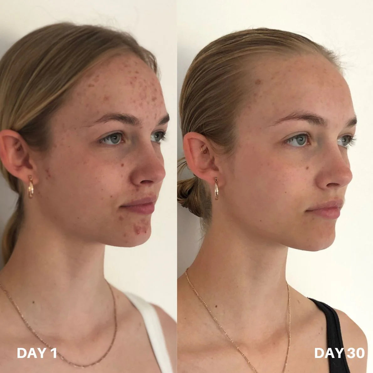 Clinisoothe+ Skin Purifier