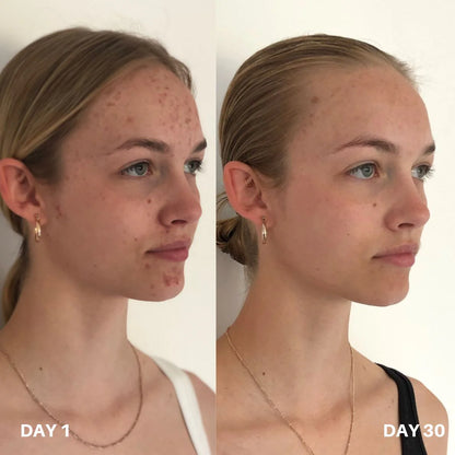 Clinisoothe+ Skin Purifier