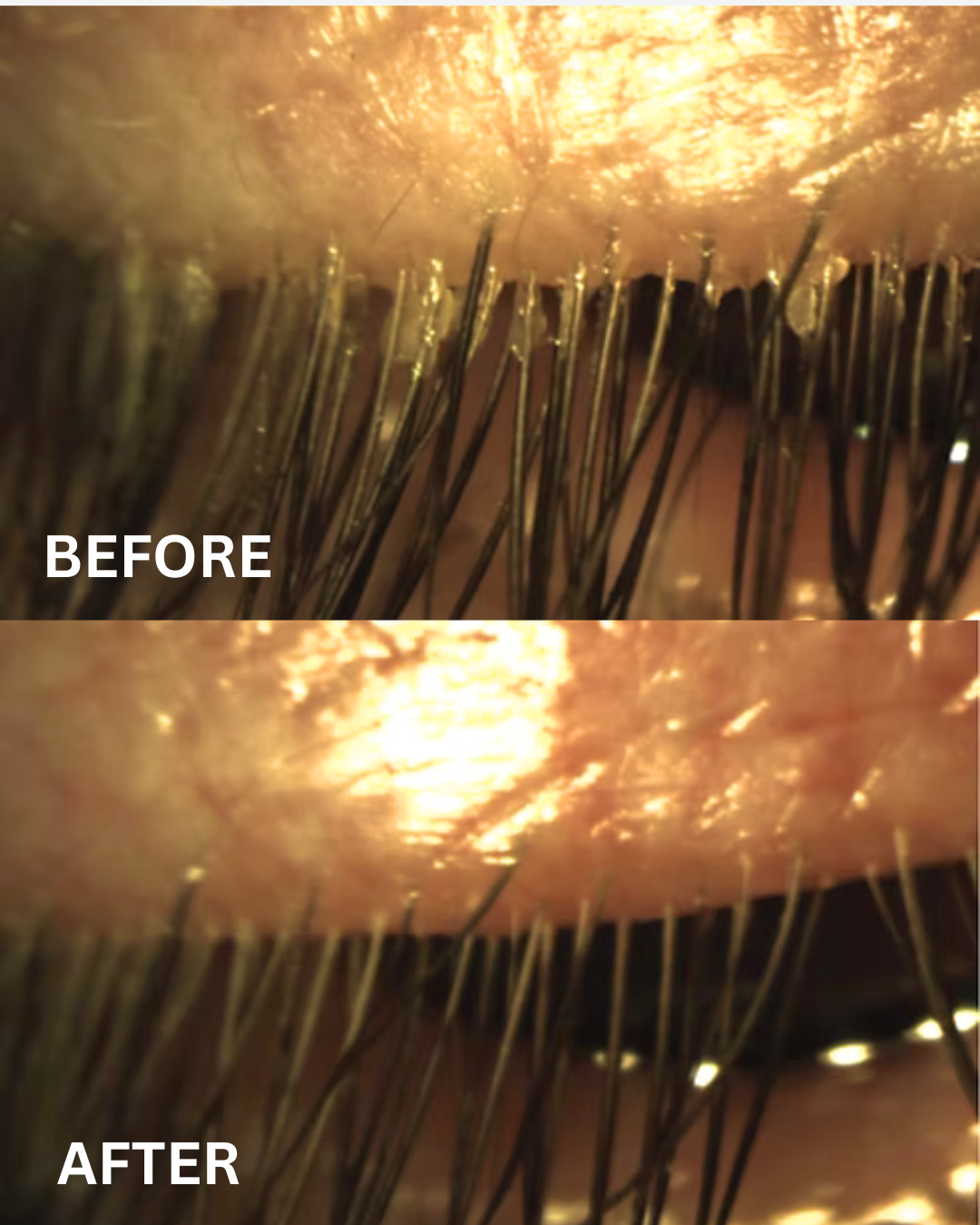 DemEx Cleansing Foam before and after