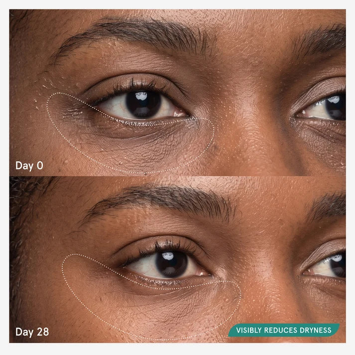 Dry Under Eye Correcting Lidstick ™