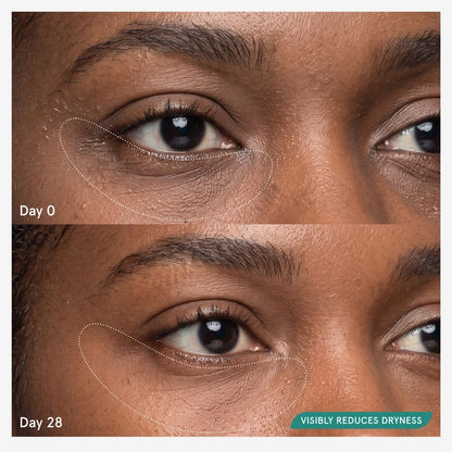 Dry Under Eye Correcting Lidstick ™